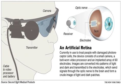 black box electrical stimulator|Little Black Boxes: Noncardiac Implantable Electronic .